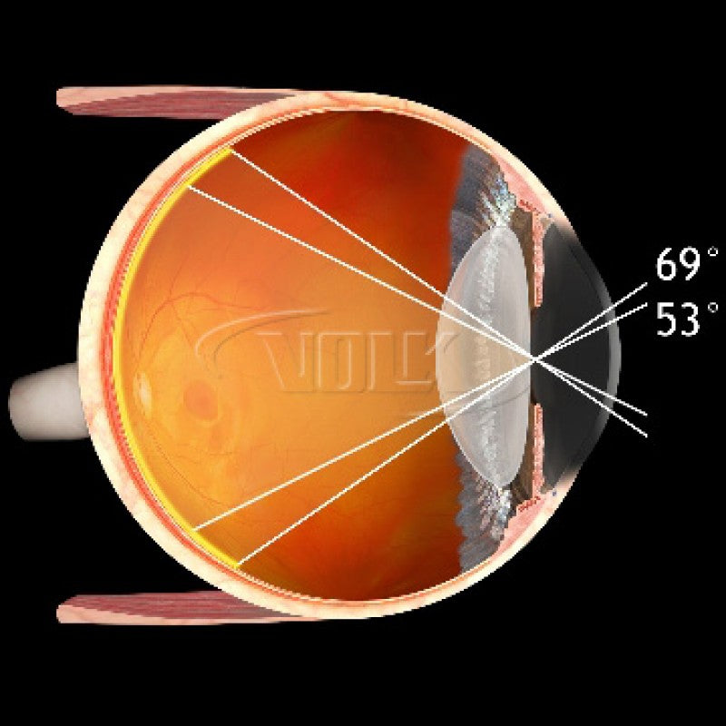 Volk Student 28D Large Aspheric Lens, Clear – Marco Lombart