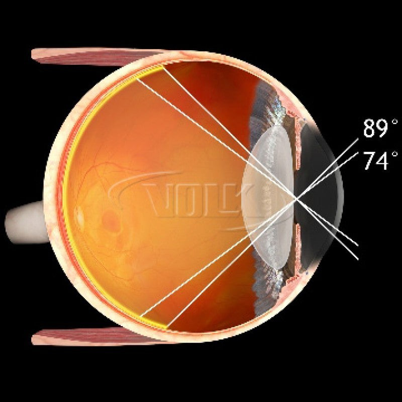 Volk 90D Small Aspheric Lens, Clear – Marco Lombart Student Portal